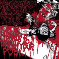 ANS : Four Bands to Drain Your Pool